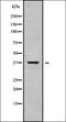 Olfactory Receptor Family 52 Subfamily B Member 6 antibody, orb336413, Biorbyt, Western Blot image 