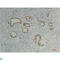 Peptidylprolyl Isomerase B antibody, LS-C813611, Lifespan Biosciences, Immunohistochemistry paraffin image 