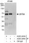 Zinc Finger And BTB Domain Containing 9 antibody, A303-244A, Bethyl Labs, Immunoprecipitation image 