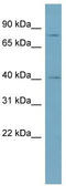 Signal Peptide Peptidase Like 2C antibody, TA337560, Origene, Western Blot image 