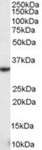 Killer Cell Lectin Like Receptor K1 antibody, TA303045, Origene, Western Blot image 