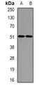 Eukaryotic Translation Initiation Factor 2 Subunit Gamma antibody, orb341117, Biorbyt, Western Blot image 