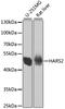 Probable histidyl-tRNA synthetase, mitochondrial antibody, A7785, ABclonal Technology, Western Blot image 