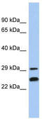 NSE2 (MMS21) Homolog, SMC5-SMC6 Complex SUMO Ligase antibody, TA331411, Origene, Western Blot image 