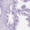 Chromosome 7 Open Reading Frame 57 antibody, NBP1-91074, Novus Biologicals, Immunohistochemistry paraffin image 