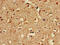 Sprouty Related EVH1 Domain Containing 1 antibody, CSB-PA773600LA01HU, Cusabio, Immunohistochemistry paraffin image 