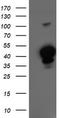 Heme Oxygenase 2 antibody, CF503822, Origene, Western Blot image 