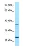 Ribosomal Protein S5 antibody, NBP1-98403, Novus Biologicals, Western Blot image 