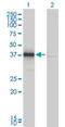 DnaJ Heat Shock Protein Family (Hsp40) Member B4 antibody, H00011080-M01, Novus Biologicals, Western Blot image 
