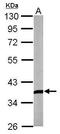 Dickkopf WNT Signaling Pathway Inhibitor 3 antibody, TA308781, Origene, Western Blot image 
