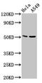 Chordin Like 1 antibody, CSB-PA866283LA01HU, Cusabio, Western Blot image 