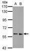 Zinc Finger And SCAN Domain Containing 32 antibody, GTX116267, GeneTex, Western Blot image 