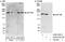 Nucleoporin 188 antibody, A302-323A, Bethyl Labs, Immunoprecipitation image 