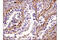 Vinculin antibody, 13901S, Cell Signaling Technology, Immunohistochemistry paraffin image 