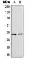 Galectin 8 antibody, orb216142, Biorbyt, Western Blot image 
