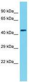 Phosphorylase b kinase gamma catalytic chain, skeletal muscle isoform antibody, TA345154, Origene, Western Blot image 