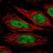 Nucleoporin 188 antibody, NBP2-38936, Novus Biologicals, Immunofluorescence image 