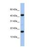 Uncharacterized protein FLJ37543 antibody, NBP1-79599, Novus Biologicals, Western Blot image 