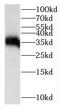 Insulin Like Growth Factor Binding Protein 1 antibody, FNab04175, FineTest, Western Blot image 