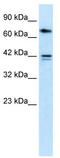 Calcium Voltage-Gated Channel Auxiliary Subunit Beta 1 antibody, TA338371, Origene, Western Blot image 