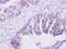 PML antibody, PA5-28720, Invitrogen Antibodies, Immunohistochemistry paraffin image 