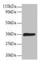 ATPase H+ Transporting V1 Subunit E1 antibody, LS-C211159, Lifespan Biosciences, Western Blot image 