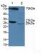 Amyloid P Component, Serum antibody, MBS2026119, MyBioSource, Western Blot image 