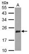 Nudix Hydrolase 3 antibody, NBP2-15048, Novus Biologicals, Western Blot image 