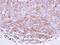 Intercellular Adhesion Molecule 2 antibody, LS-C185819, Lifespan Biosciences, Immunohistochemistry frozen image 