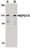 Zinc finger FYVE domain-containing protein 26 antibody, PA5-20685, Invitrogen Antibodies, Western Blot image 