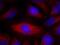 Phospholipase C Gamma 2 antibody, 79-427, ProSci, Immunofluorescence image 