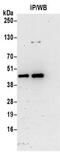 TRNA Methyltransferase 10C, Mitochondrial RNase P Subunit antibody, NBP2-32078, Novus Biologicals, Immunoprecipitation image 