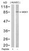 Ribosomal Protein S6 Kinase A5 antibody, 79-578, ProSci, Western Blot image 
