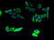 ELOVL Fatty Acid Elongase 5 antibody, A67758-100, Epigentek, Immunofluorescence image 