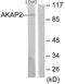 A-Kinase Anchoring Protein 2 antibody, LS-C119338, Lifespan Biosciences, Western Blot image 