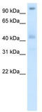 Pogo Transposable Element Derived With ZNF Domain antibody, TA343769, Origene, Western Blot image 