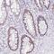 Deltex E3 Ubiquitin Ligase 4 antibody, HPA056760, Atlas Antibodies, Immunohistochemistry frozen image 
