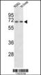 Peroxisomal carnitine O-octanoyltransferase antibody, 63-919, ProSci, Western Blot image 