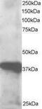 GIPC PDZ Domain Containing Family Member 3 antibody, PA1-32075, Invitrogen Antibodies, Western Blot image 