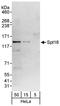 Spermatogenesis Associated 16 antibody, A302-492A, Bethyl Labs, Western Blot image 