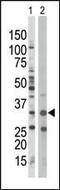 Protein Kinase AMP-Activated Non-Catalytic Subunit Beta 1 antibody, PA5-13791, Invitrogen Antibodies, Western Blot image 