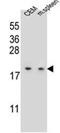 LSM7 Homolog, U6 Small Nuclear RNA And MRNA Degradation Associated antibody, AP52555PU-N, Origene, Western Blot image 