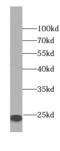 Calcyphosine antibody, FNab01197, FineTest, Western Blot image 