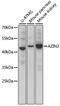 Arginine decarboxylase antibody, 16-332, ProSci, Western Blot image 