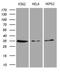 Clathrin Light Chain A antibody, LS-C795050, Lifespan Biosciences, Western Blot image 