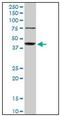 Abhydrolase Domain Containing 5 antibody, AM31371PU-N, Origene, Western Blot image 