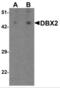 Developing Brain Homeobox 2 antibody, NBP2-82083, Novus Biologicals, Western Blot image 