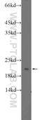 Ribosomal Protein Lateral Stalk Subunit P1 antibody, 21636-1-AP, Proteintech Group, Western Blot image 