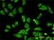 Ribosomal Protein L36a antibody, H00006173-M02, Novus Biologicals, Immunocytochemistry image 
