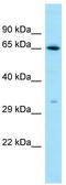 LHRHR antibody, TA343097, Origene, Western Blot image 